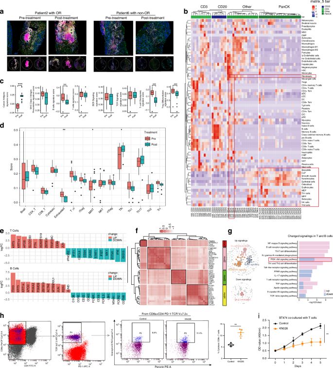 Fig. 4: Intratumoral immune infiltrations within full-tumor sections following KN026 treatment.