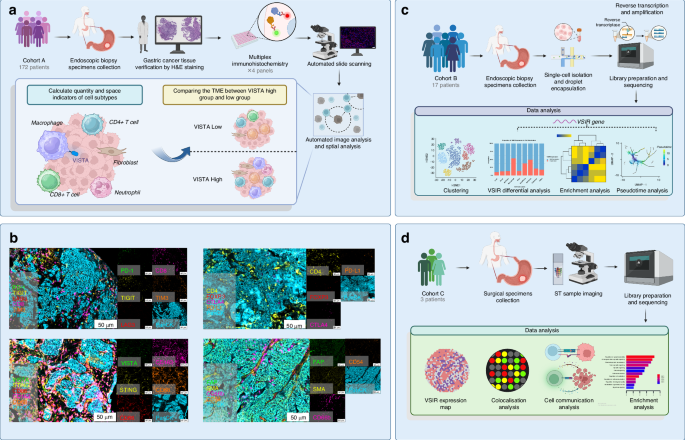 Fig. 1: Identification and characterisation of the tumour microenvironment in GC patients according to VISTA expression.