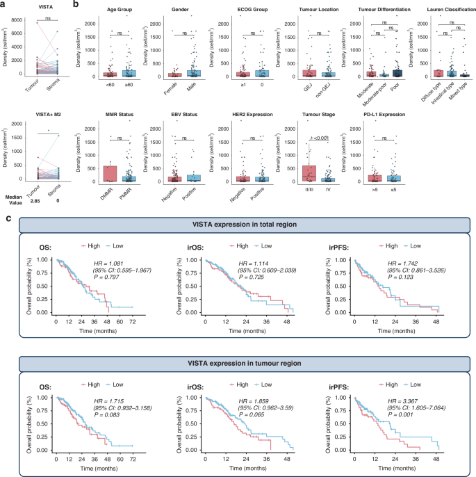 Fig. 2: The association of VISTA expression with clinicopathological and prognostic features in GC.
