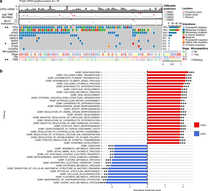 Fig. 3: Somatic mutations and gene expression patterns in UPK2-positive colorectal cancer.