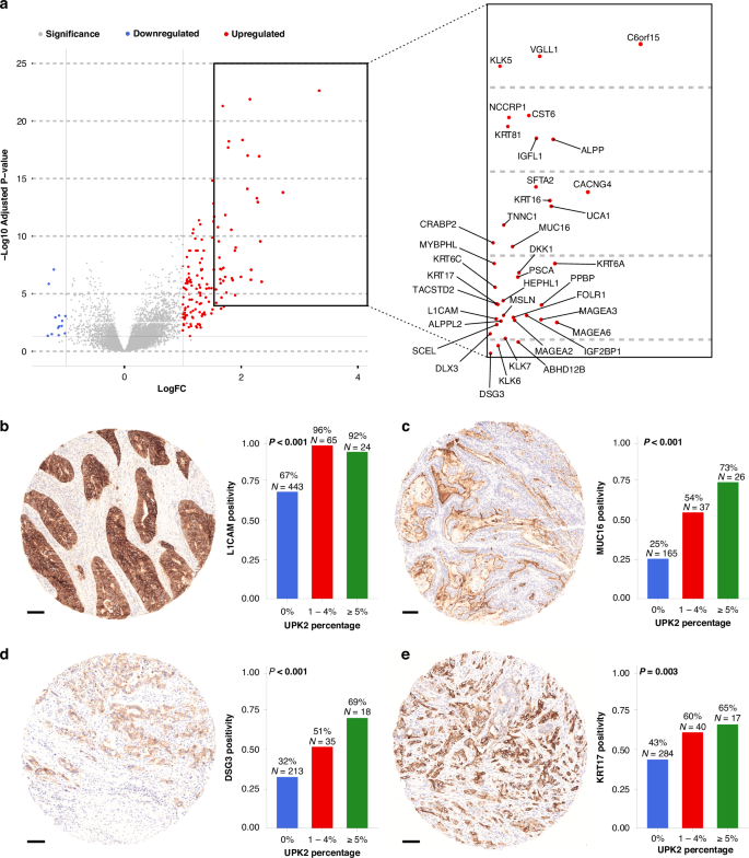 Fig. 4: Differentially expressed genes and immunohistochemical validations in UPK2-positive colorectal cancer.