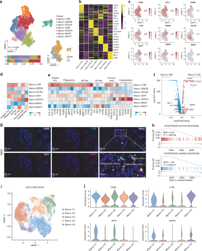 Fig. 2: Identification of LY6E+ macrophages in human ESCC.