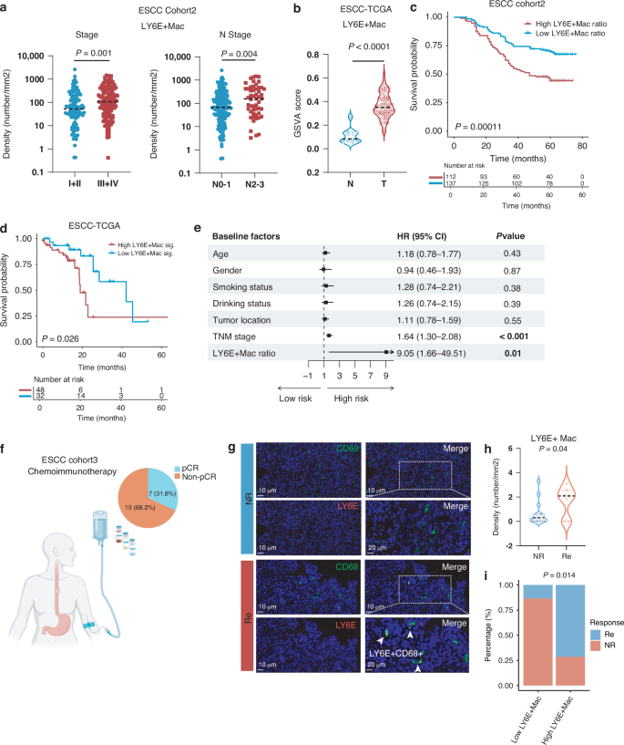 Fig. 3: LY6E+ macrophages abundance correlates with poor prognosis but well response to ICB in ESCC.
