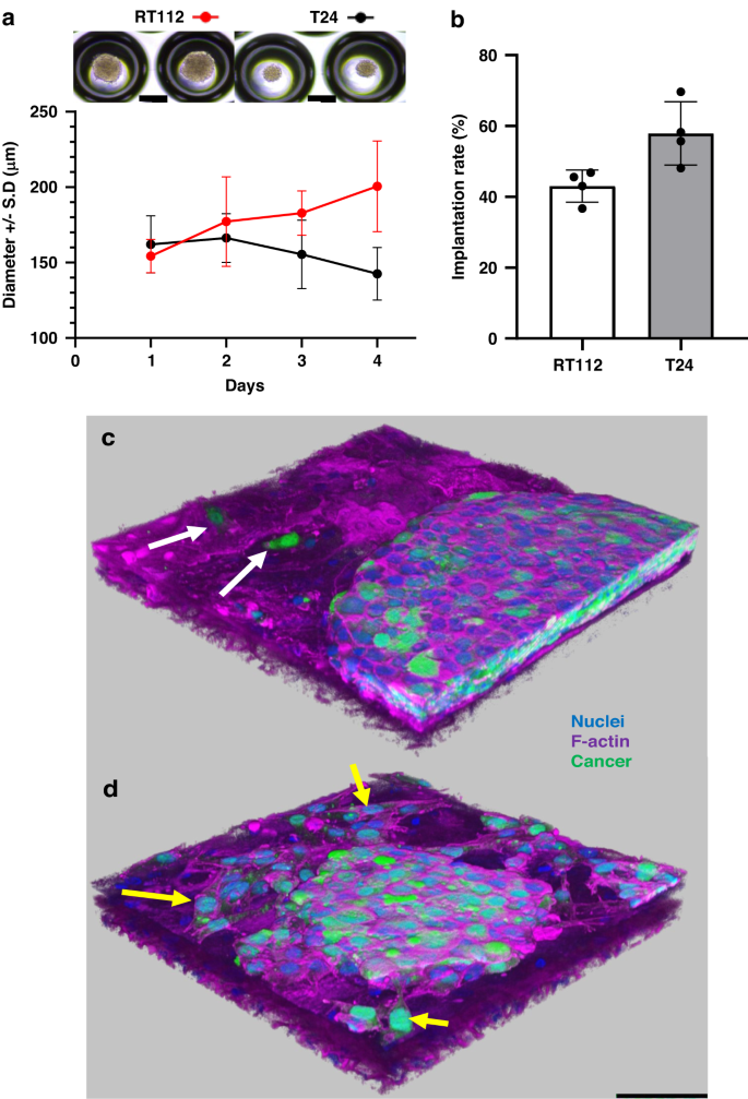 Fig. 1: 3D-UHU-TU Generation.