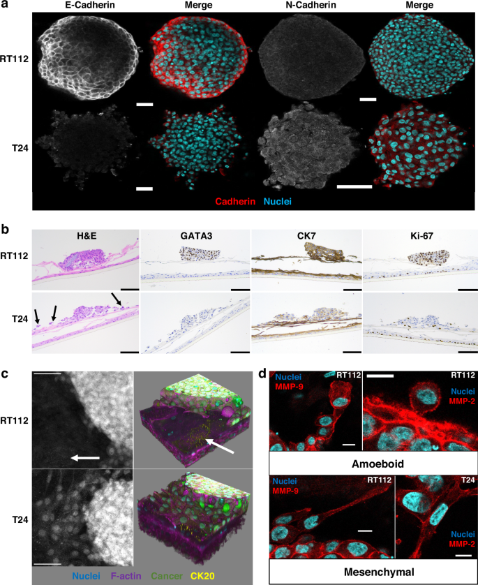 Fig. 2: Expression of various markers in 3D-UHU-TU.