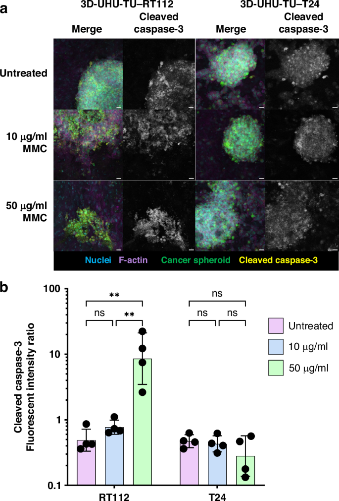 Fig. 4: Automatic image analysis quantification of MMC treatment of 3D-UHU-TU models.
