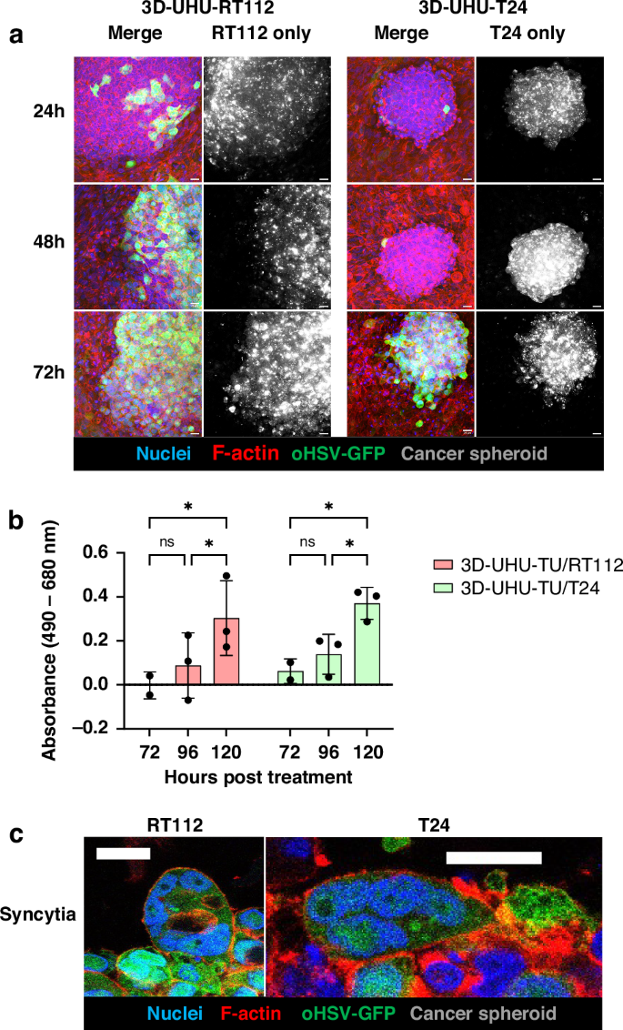 Fig. 5: oHSV-GFP treatment of 3D-UHU-TU models.