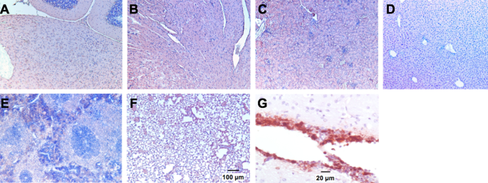 Safety And Efficacy Of Oncolytic Hsv 1 G207 Inoculated Into The Cerebellum Of Mice Cancer Gene Therapy