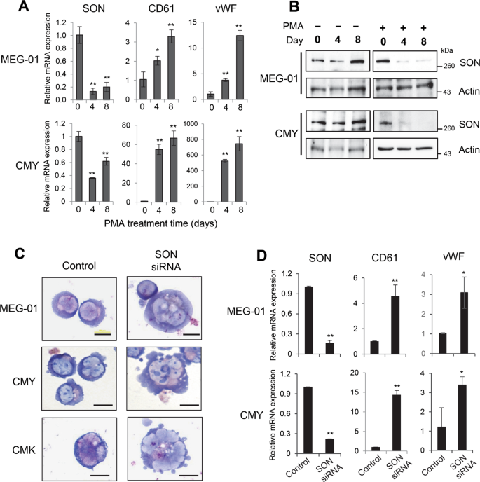SON inhibits megakaryocytic differentiation via repressing RUNX1 and the megakaryocytic gene expression program in acute megakaryoblastic leukemia | Cancer Gene Therapy