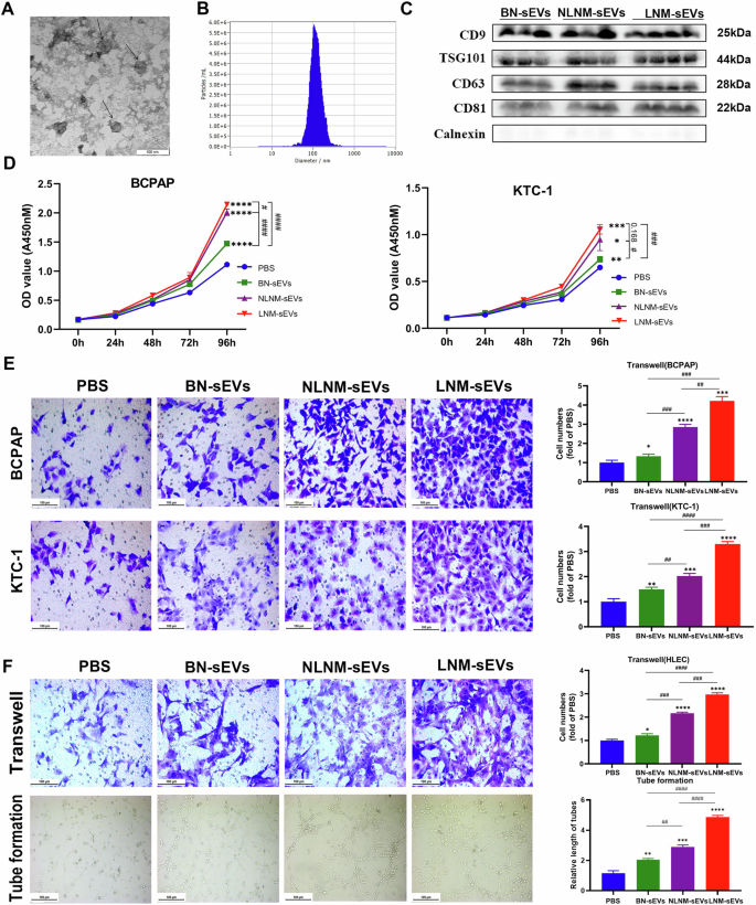 Fig. 2: Verification of sEVs isolated from pooled serum and sEVs from PTMC patients promoted PTC cell proliferation and migration.