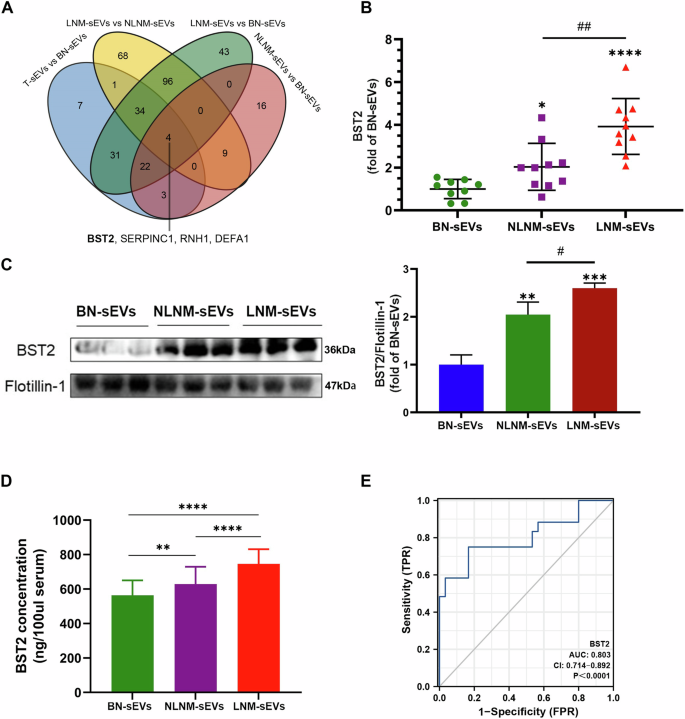 Fig. 4: The correlation of differentially expressed protein levels of BST2 in serum sEVs with PTMC progression.