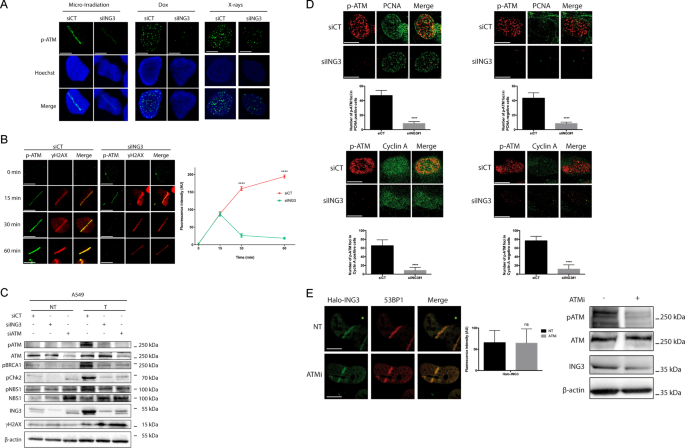 ing3 is required for atm signaling and dna repair in response to dna double strand breaks cell death differentiation