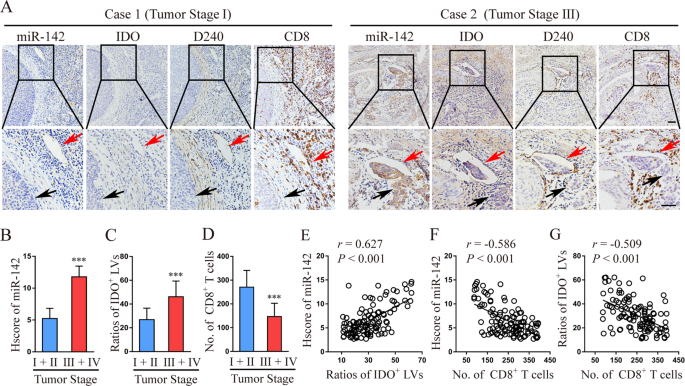 Fig. 1: miR-142-5p expression correlates with lymphatic IDO expression and is negatively associated with the number of infiltrating CD8+ T cells during CSCC progression.