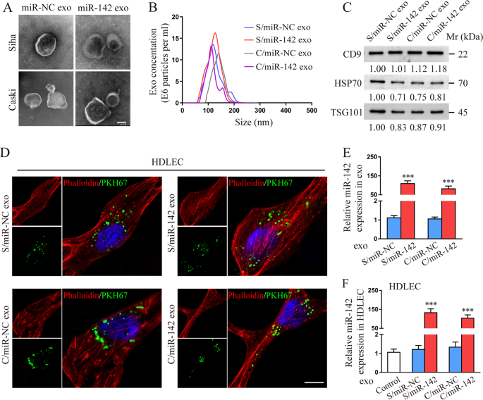 Fig. 2: miR-142-5p can be transferred to human dermal lymphatic endothelial cells (HDLECs) via CSCC-secreted exosomes.