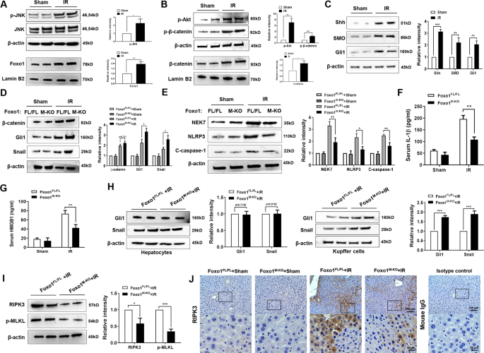 Functional Crosstalk Between Myeloid Foxo1 B Catenin Axis And Hedgehog Gli1 Signaling In Oxidative Stress Response Cell Death Differentiation