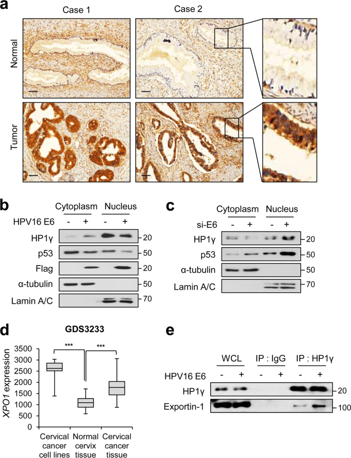 hpv lung cancer immunohistochemistry