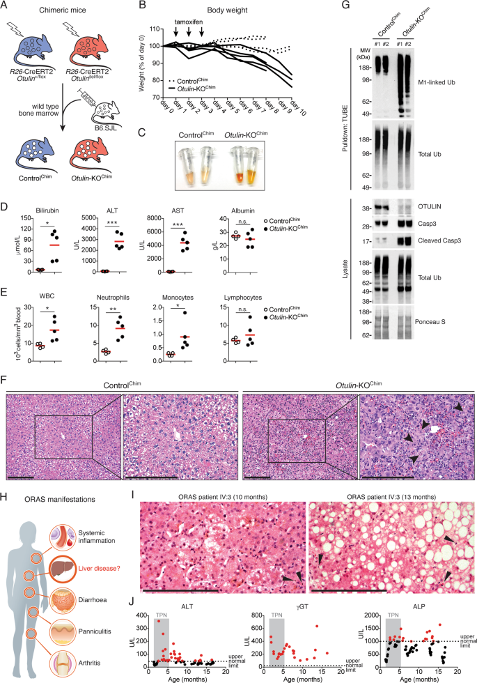 Otulin Protects The Liver Against Cell Death Inflammation Fibrosis And Cancer Cell Death Differentiation