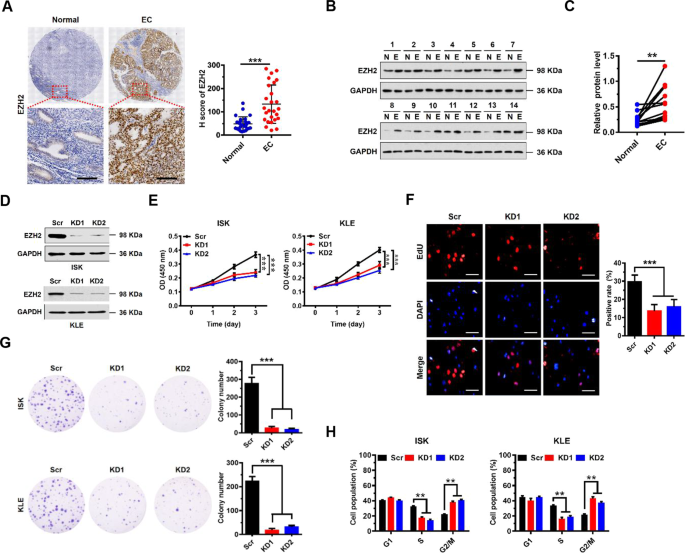 Fig. 1: Upregulation of EZH2 correlates with poor prognosis in EC, and promotes EC cell proliferation in vitro.