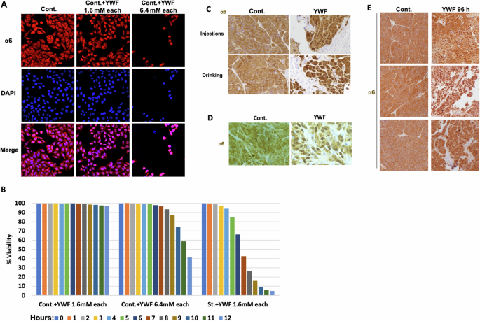 Fig. 4: The YWF-stimulated cascade governs proteasome dynamics also in non-starved cells and animal tumor models.