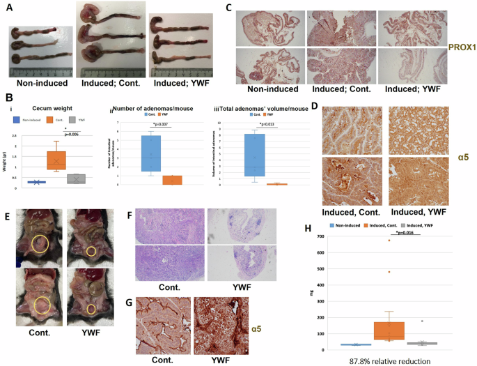 Fig. 7: Preventing proteasome recruitment inhibits endogenous tumor growth and metastasis.