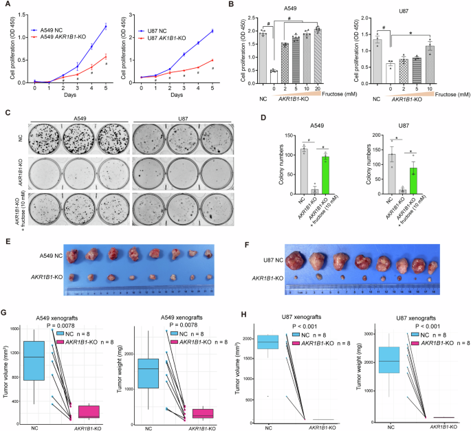 Fig. 5: AKR1B1-mediated fructose production from glucose played an extremely important role in the proliferation of cancer cells both in vitro and in vivo.