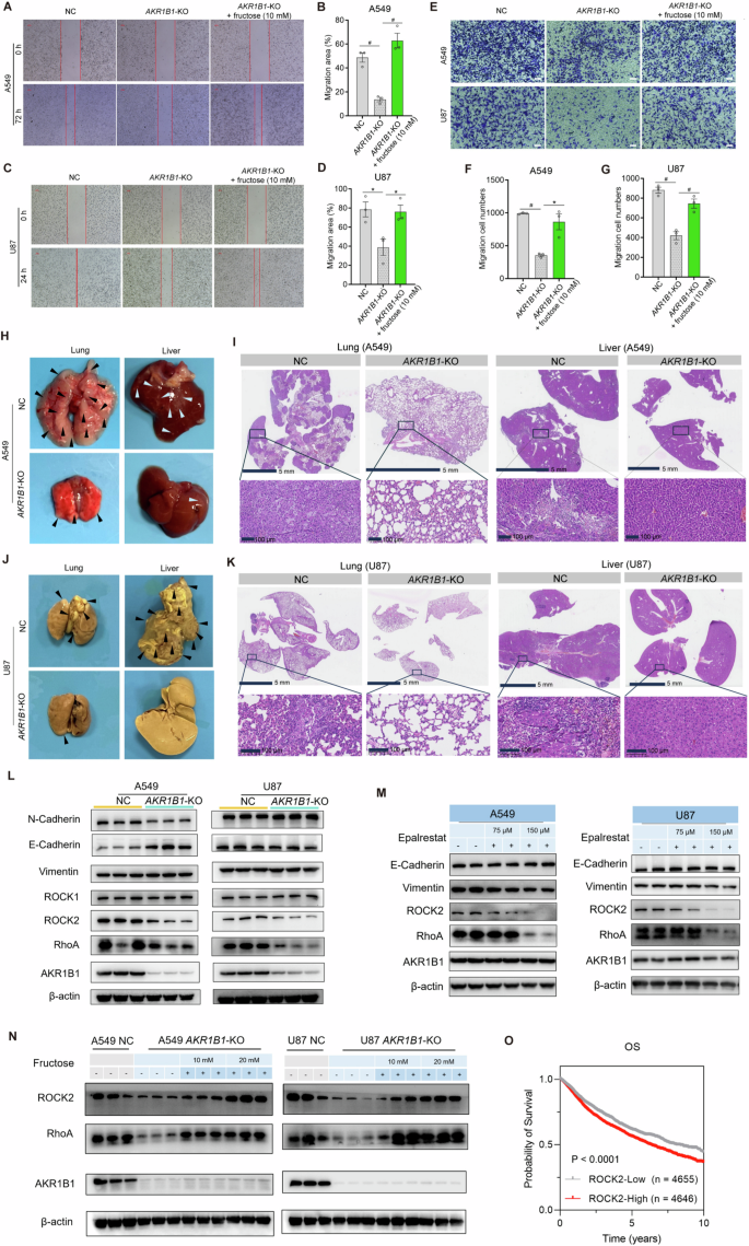 Fig. 7: AKR1B1-mediated fructose production from glucose enhanced cancer cell migration via RhoA-ROCK2 pathway.