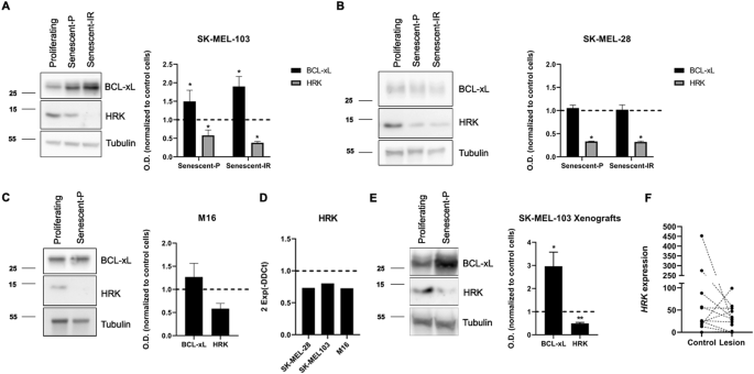 Fig. 4: BCL-xL dependence in senescent melanoma cells is mediated through HRK downregulation.