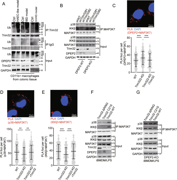 Fig. 7: Inhibition of Trim32 represses transduction of NF-κB and p38 signalings by DPEP2-mediated MAP3K7 inactivation.