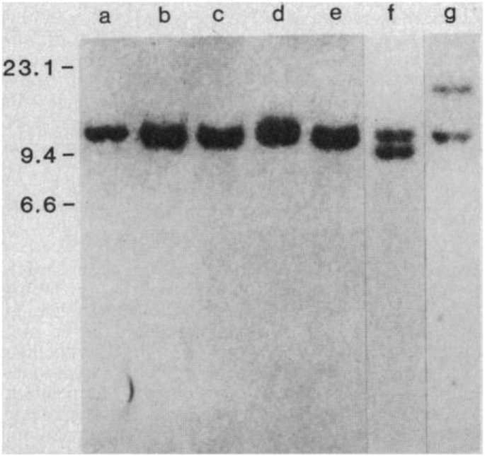 Fig. 2: Southern blot hybridization with human chromosome 18-specific probe p380j-2RR of DNA from 380 leukemic cells and LN128 lymphoma cells.