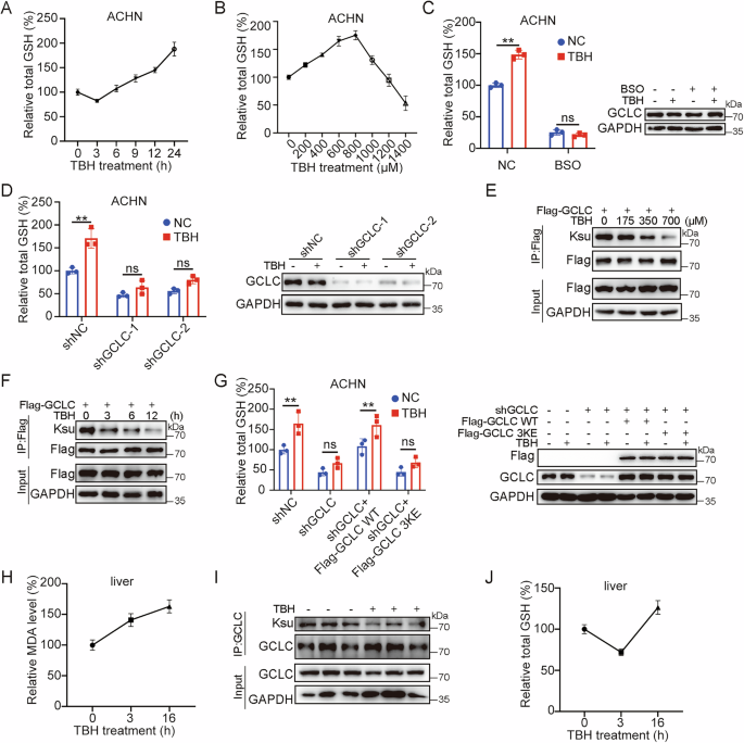 Fig. 2: TBH increases cellular GSH level through desuccinylating GCLC.