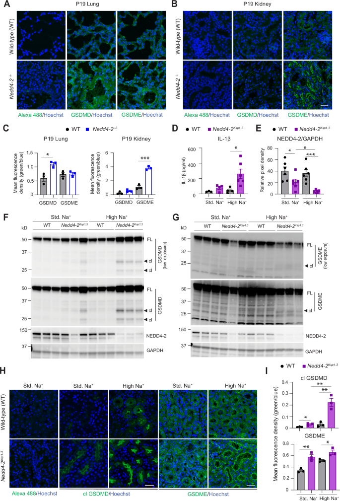 Fig. 1: High salt diet causes Gasdermin D and E activation in Nedd4-2Ksp1.3 mouse kidney.