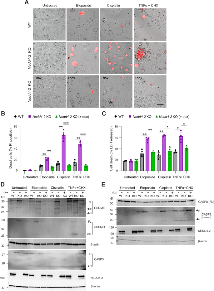 Fig. 7: Loss of NEDD4-2 causes GSDMD and GSDME activation and cell death in CCD cells which is prevented when NEDD4-2 is re-expressed.