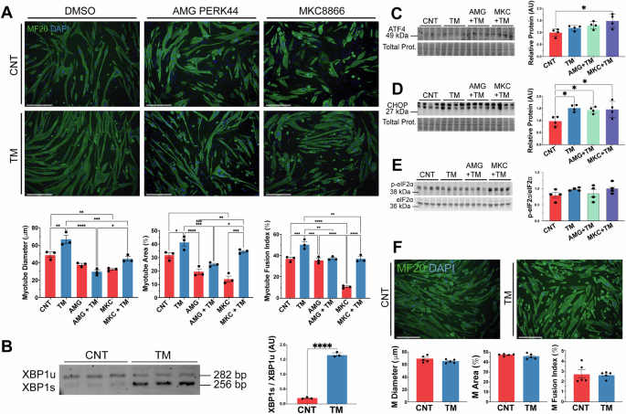 Fig. 1: Treatment of C2C12 myoblasts with an acute low concentration of the ER stressor tunicamycin (TM) promotes myogenesis.