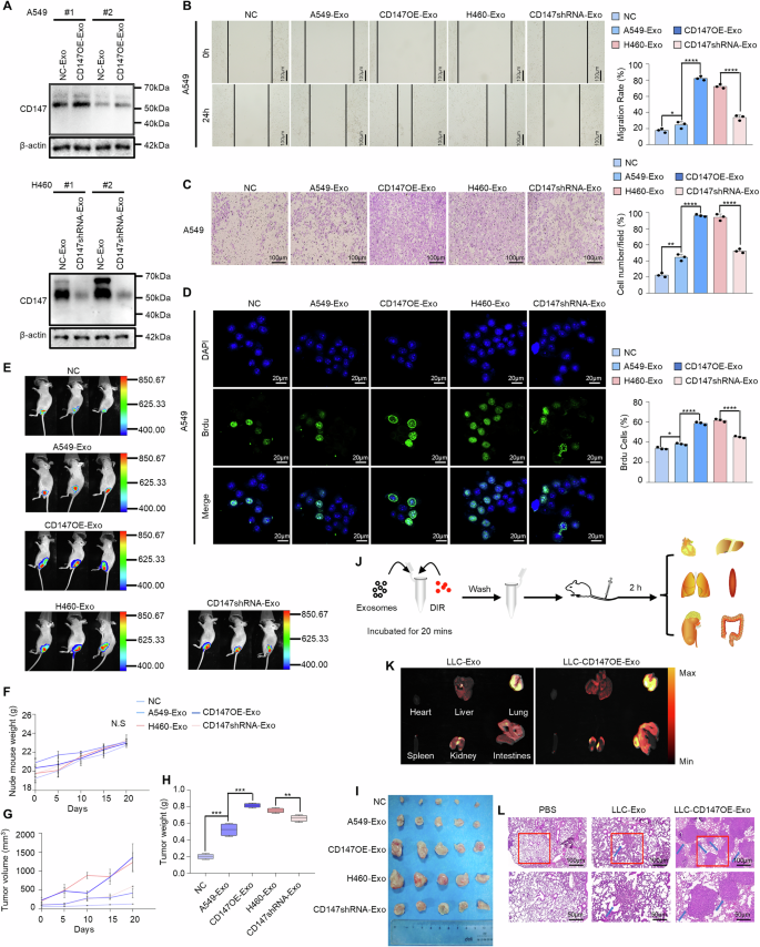 Fig. 3: CD147-derived NSCLC exosomes accelerate tumor progression.