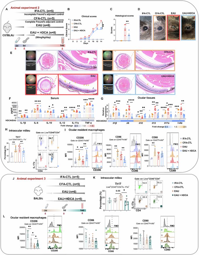 Fig. 2: HDCA alleviates AU through suppressing inflammation.