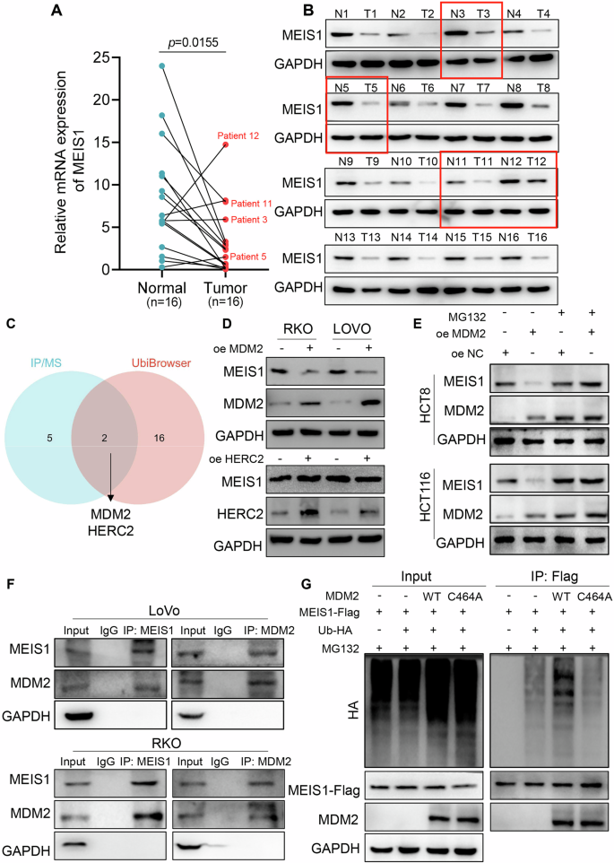 Fig. 1: MDM2 diminishes the stability of MEIS1 protein via the ubiquitin-proteasome degradation pathway.