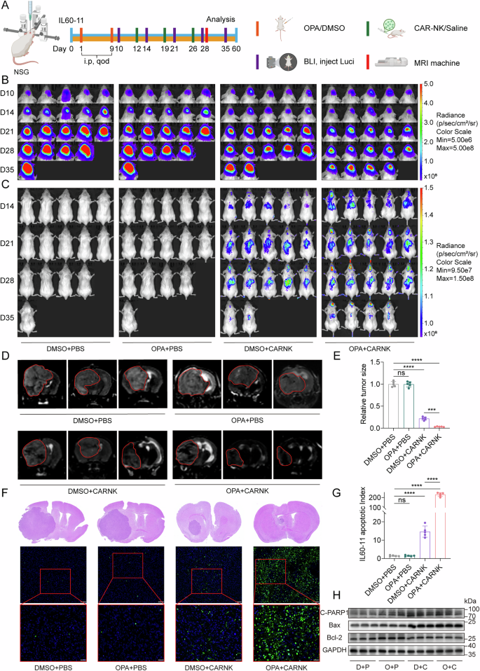 Fig. 7: Combination of OPA and EGFRvIII-CAR NK cell therapy synergistically enhances anti-tumor efficacy in orthotopic GBM PDX models.