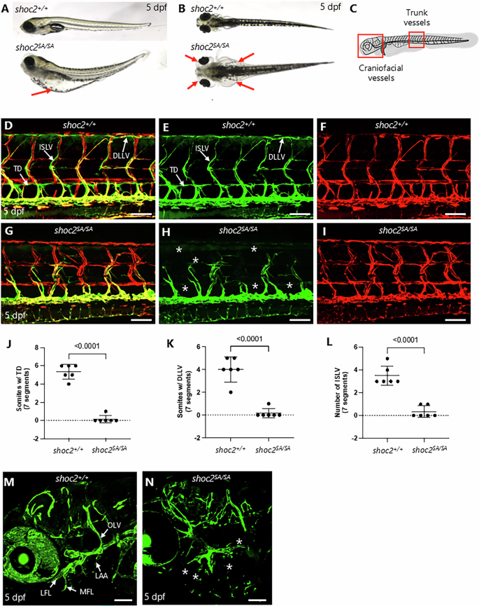 Fig. 1: Loss of lymphatics in shoc2 mutant zebrafish.