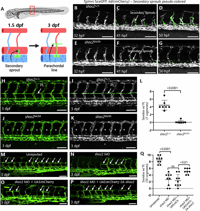 Fig. 2: Defective lymphatic progenitors in shoc2 mutant zebrafish.