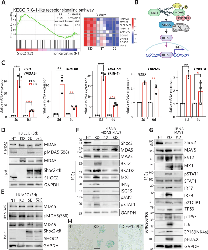 Fig. 6: Pattern recognition receptor-mediated response in the HDLEC depleted of Shoc2 or expressing the Shoc2 S2G NSLH variant.