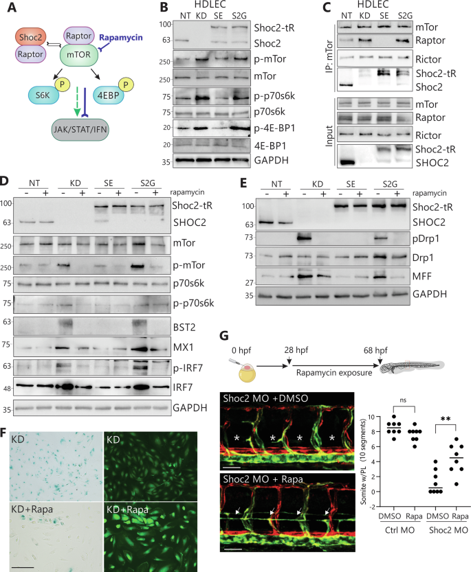 Fig. 8: Shoc2 controls mTOR pathway activation in HDLEC.