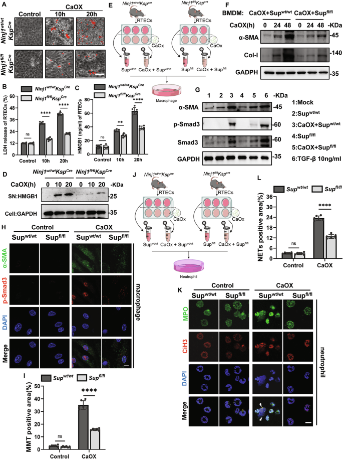 Fig. 3: NINJ1-dependent renal tubular cell membrane rupture drove NETs formation and MMT.