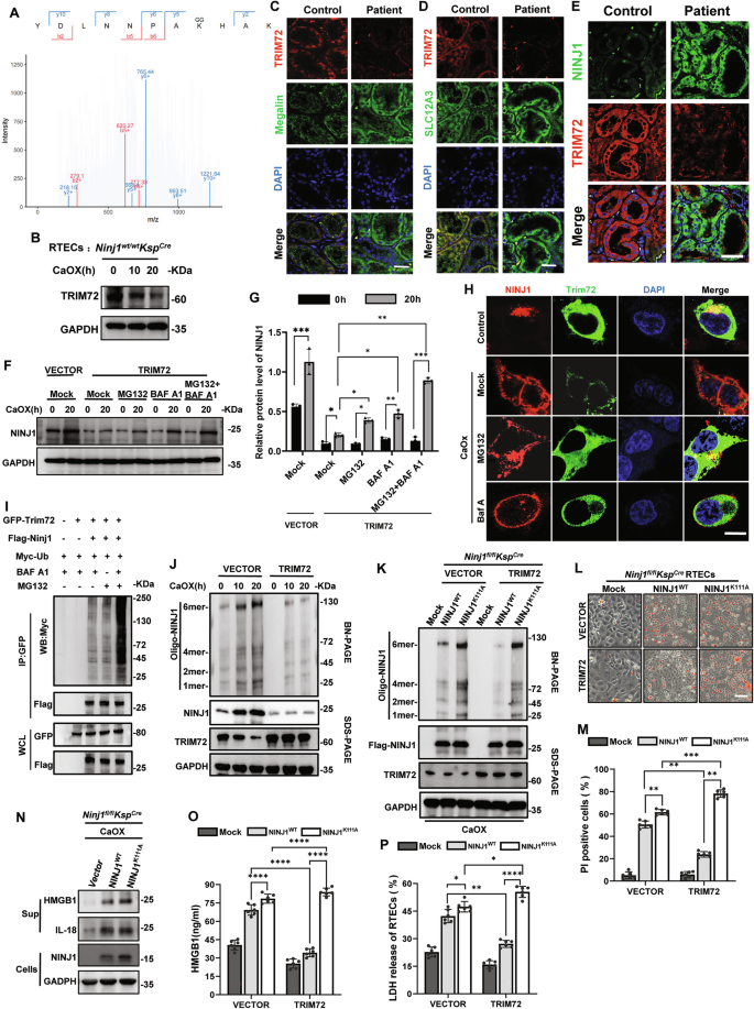 Fig. 6: TRIM72 ubiquitinates and degrades NINJ1.