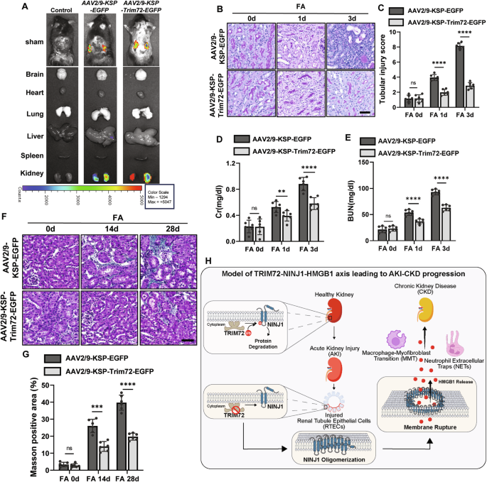 Fig. 7: Overexpressing TRIM72 mitigates NINJ1-mediated AKI-CKD progression.