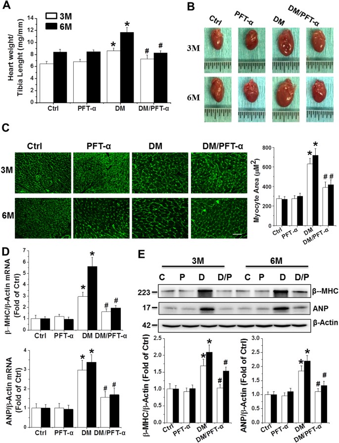 Inhibition of p53 prevents diabetic cardiomyopathy by preventing  early-stage apoptosis and cell senescence, reduced glycolysis, and impaired  angiogenesis | Cell Death & Disease