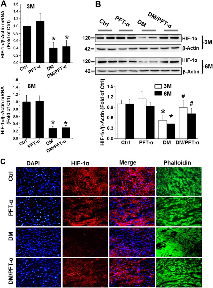 Fig. 6: p53 controls HIF-1α protein expression at 3 and 6 months after diabetes onset