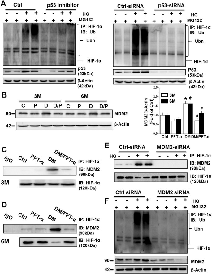 Fig. 7: p53 facilitates HIF-1α ubiquitination and consequent proteasomal degradation in an MDM2-dependent manner
