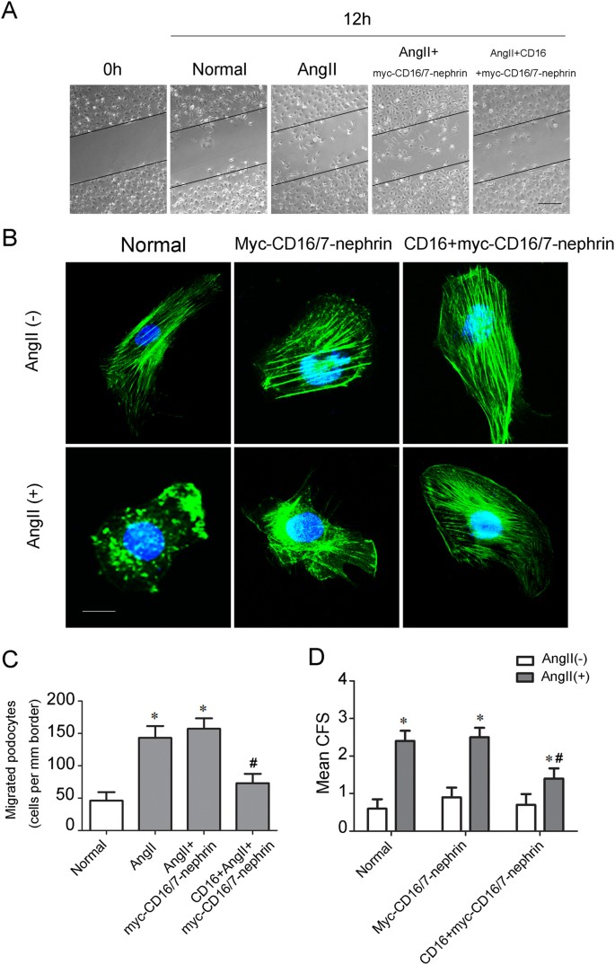 Fig. 3: Nephrin phosphorylation restores Ang II-induced podocyte cytoskeleton reorganization.