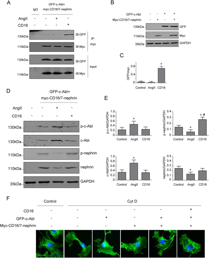 Fig. 4: The interaction between phospho-nephrin and c-Abl in COS7 cells co-transfected with myc-CD16/7-nephrin and GFP-c-Abl.