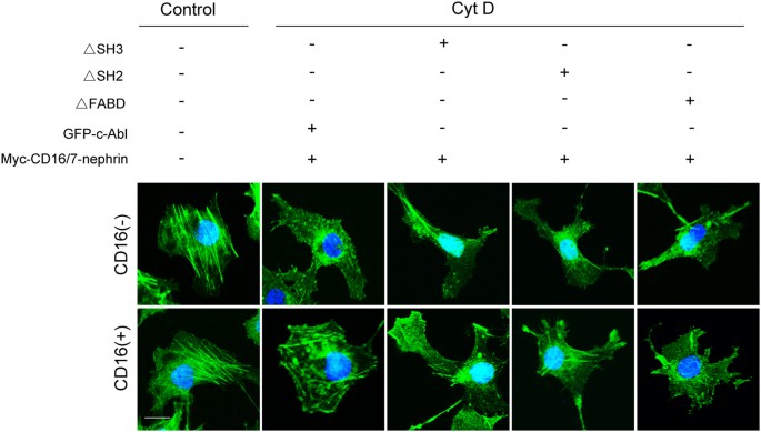 Fig. 6: Involvement of the phospho-nephrin and c-Abl interaction in cytoskeletal regulation.